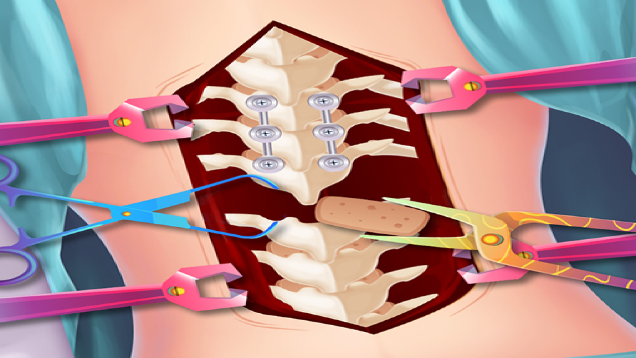 Free Play Anna Scoliosis Surgery Games Online Now