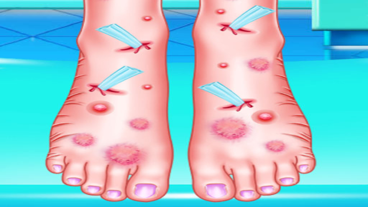 Free Emma Foot Treatment Game Online Now