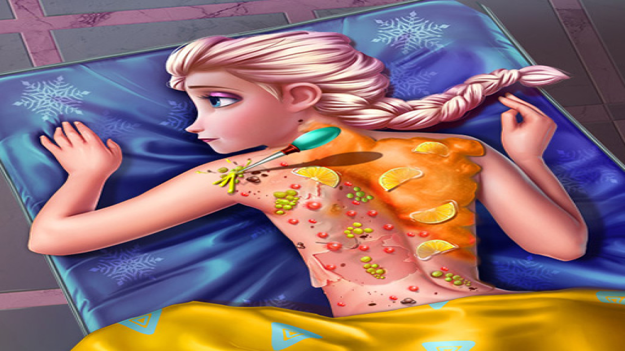 Free Play Ice Queen Back Treatment Online iOS Game