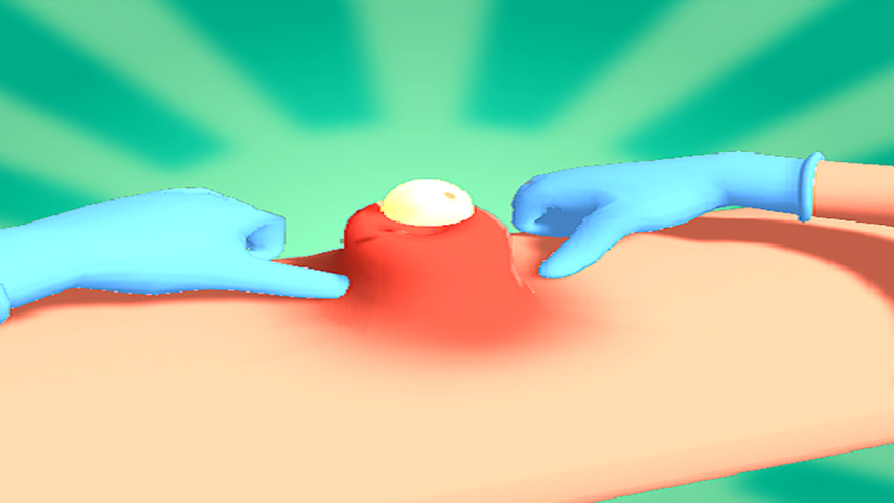 Play Pimple Squeeze Now No Download