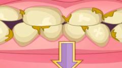 Free Bad Teeth Makeover Mobile Game Now